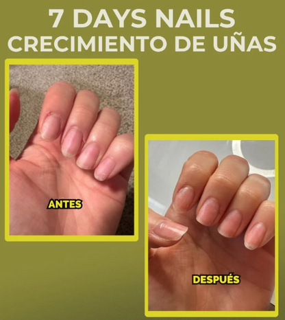 Base Uñas 4k - Fortalece, Repara Uñas y Luce uñas largas🔥PROMOCION 3 X 1 LLEVA GRATIS  DOS UNIDADES ADICIONALES🔥